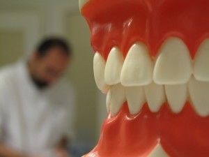 Image of mold of teeth